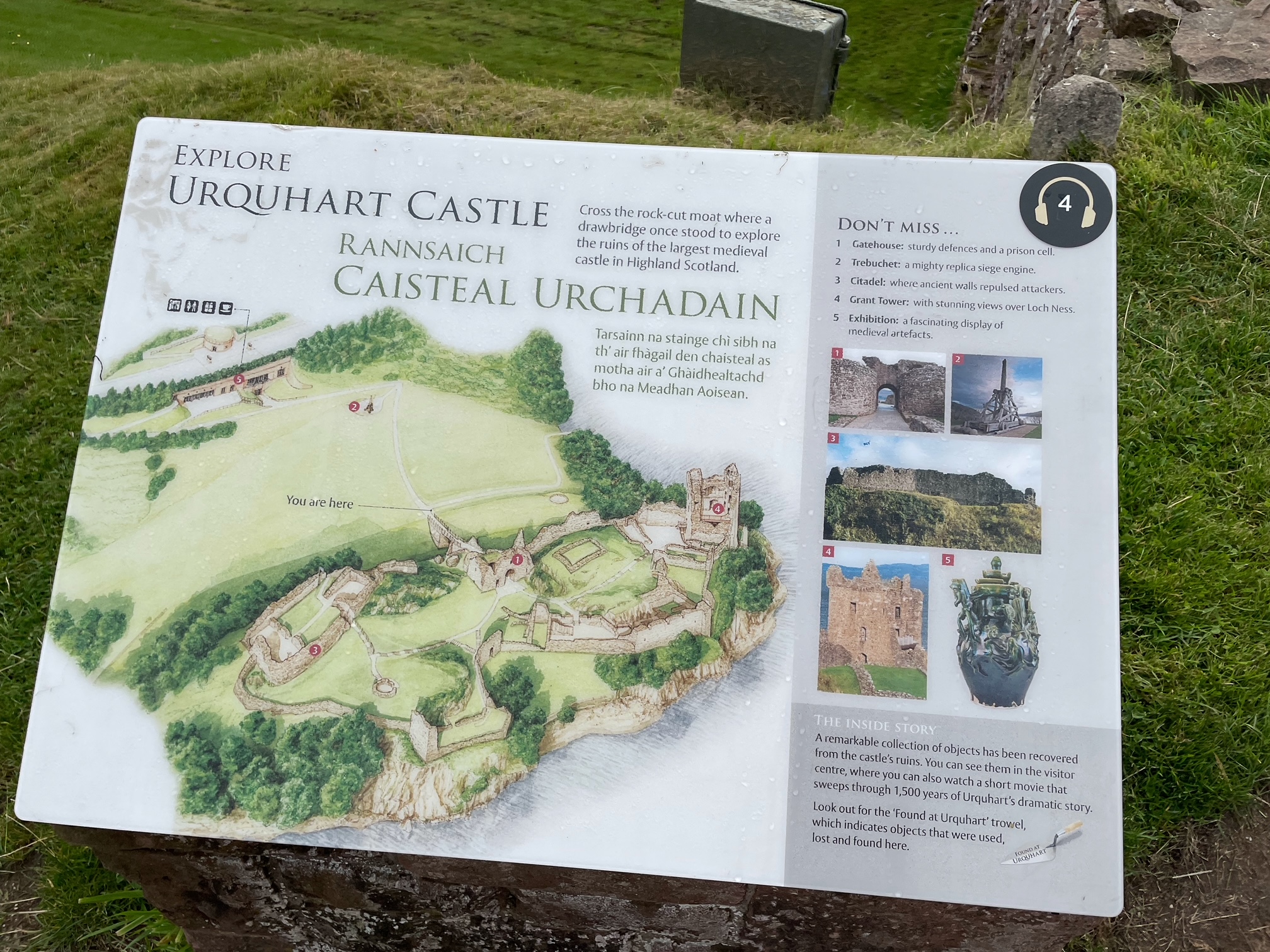Urquhart Sign